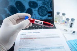 A gloved hand holding a blood sample vial with an MPOX label; background is research form for MPOX, vaccine vials, cells